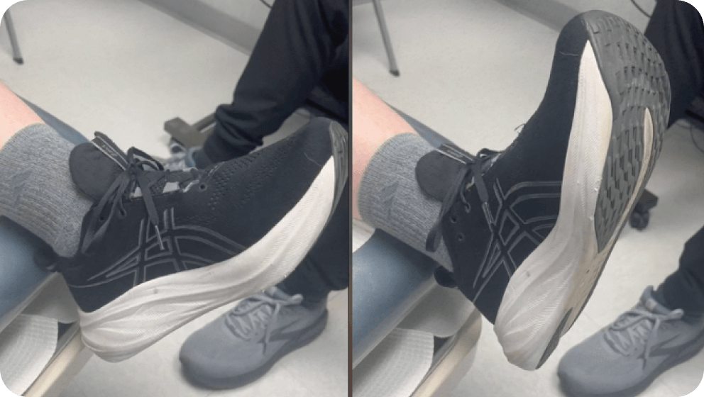 Foot Drop -Kyle McKray Smith